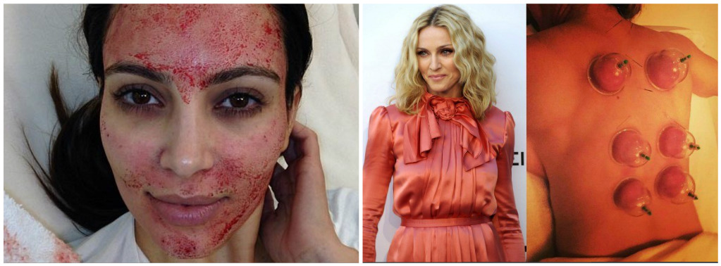 celebrities με τις πιο περίεργες "θεραπείες" ομορφιάς
